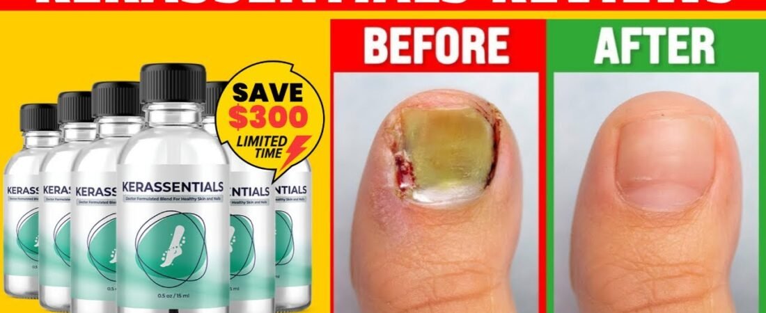 Kerassentials Review (2026): Does This Fungus Oil Really Work?