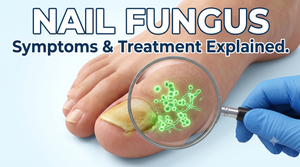 nail fungus